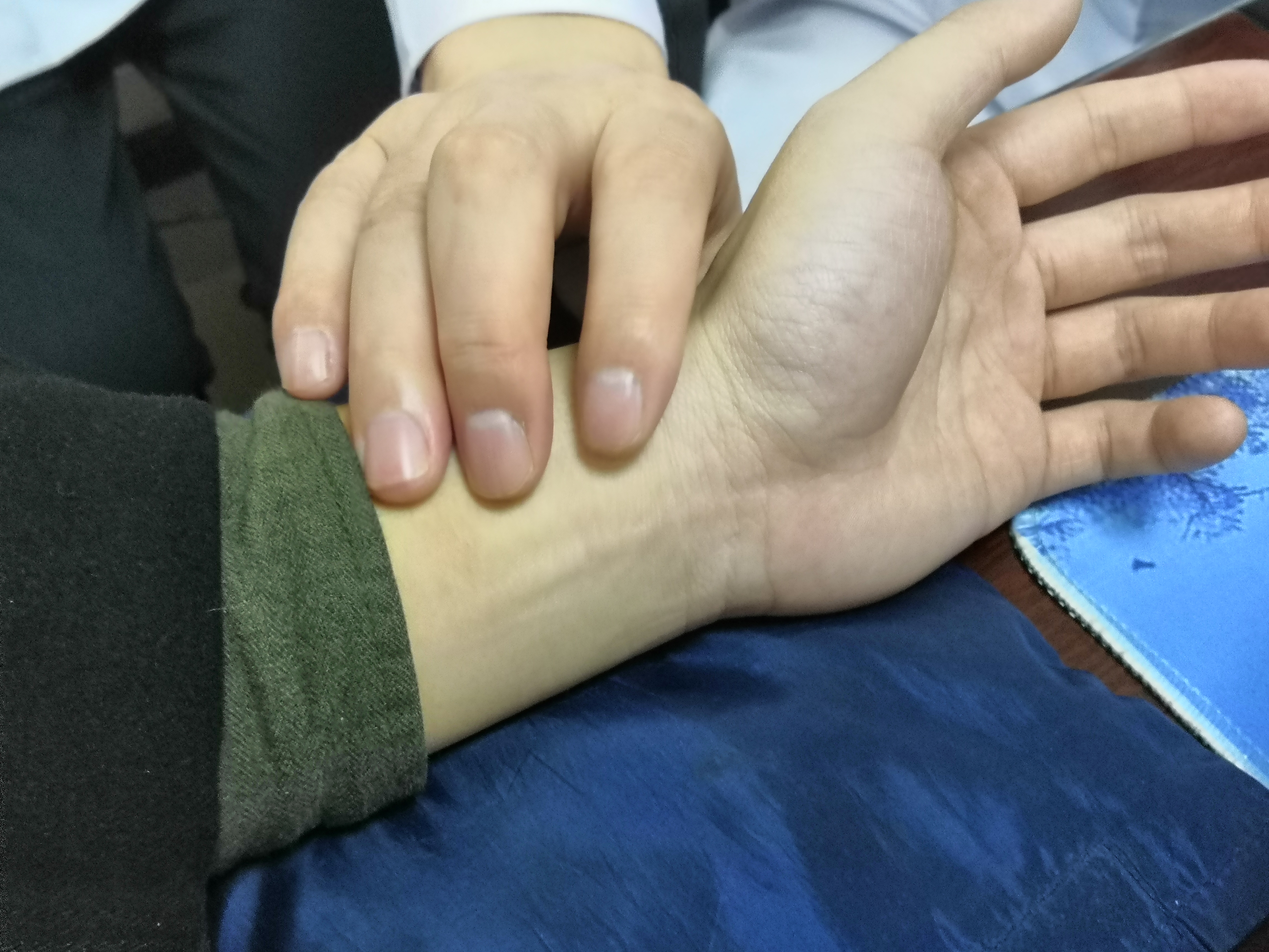 早晨小便出现“尿后滴白”现象要重视