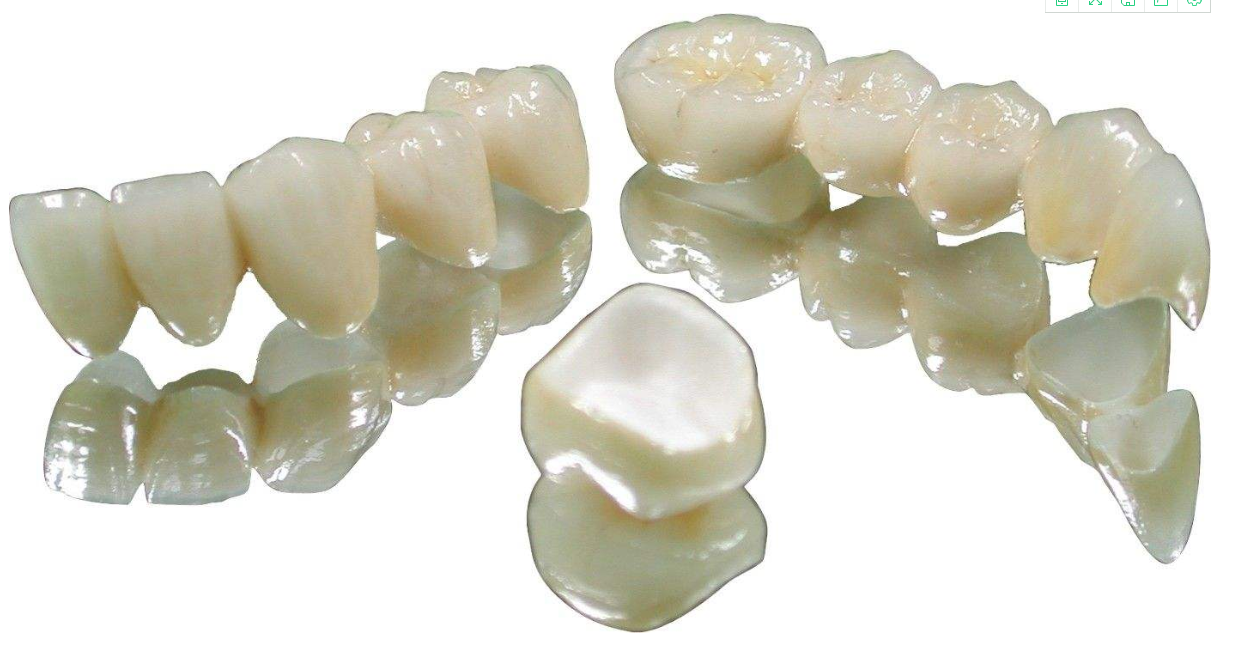 牙齿矫正美容冠的价格什么是美牙冠