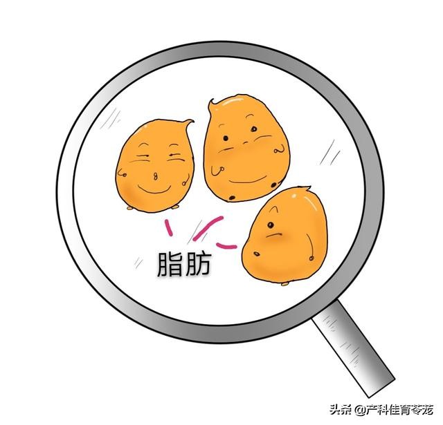 怎么判断是脂肪液化?