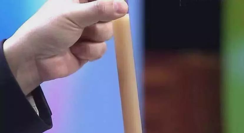 桥本氏甲状腺炎，能治愈吗？会不会癌变？你想知道的都在这