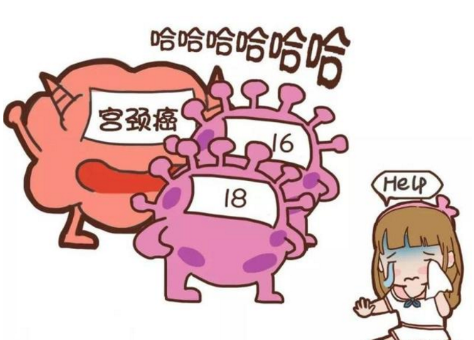 HPV检查结果解读：TCT检测报告怎么看？