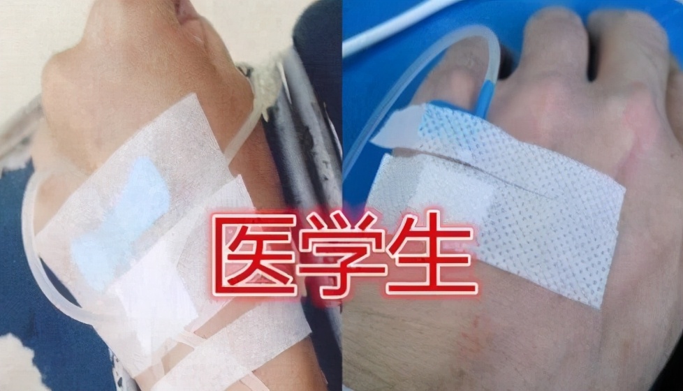 同样是“秀手”，美术生手脏艺术生手美，医学生的手叫人心酸