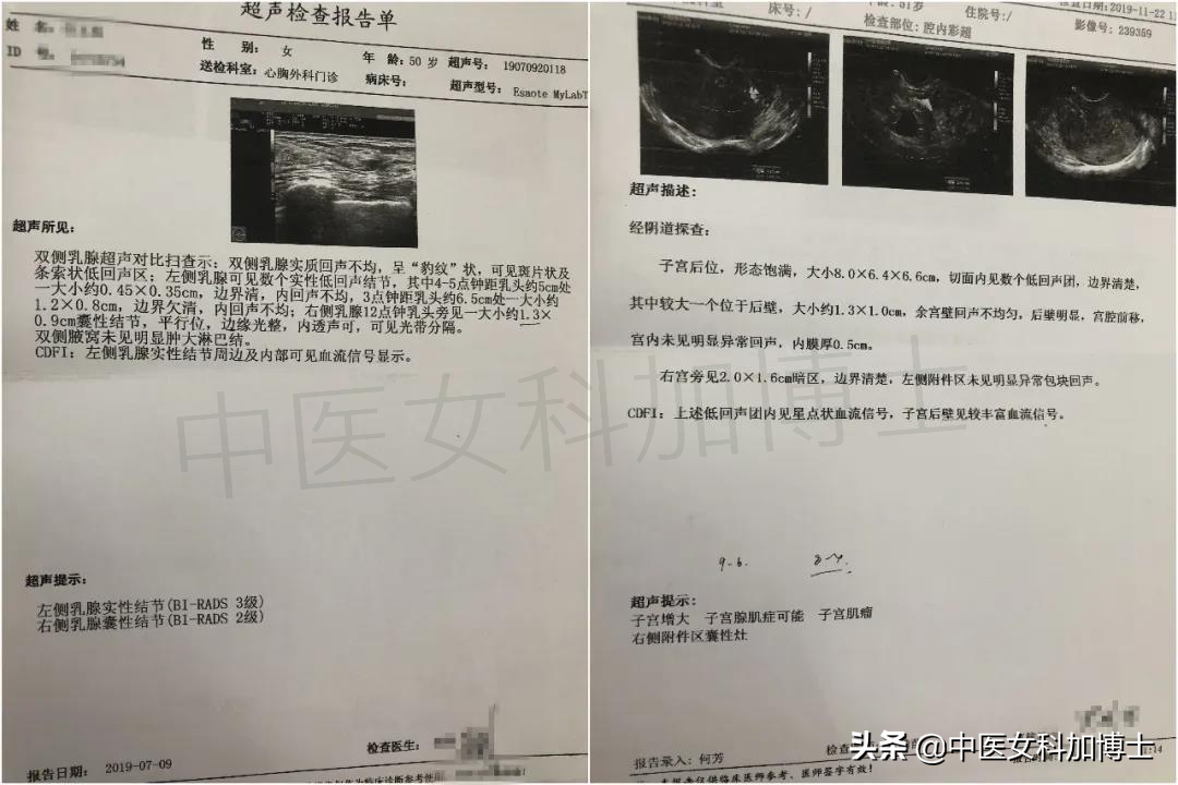 囊肿7cm到2cm，痛经消失，肌瘤变小，好转的她们都有这个共同点