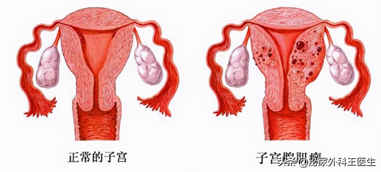 什么是“阴式”B超？检查需要哪些步骤？建议男女都了解一下