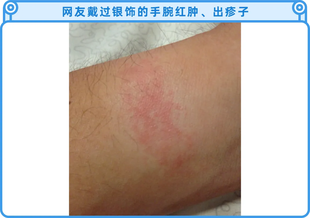 千万别乱戴银饰,里面的水有点深