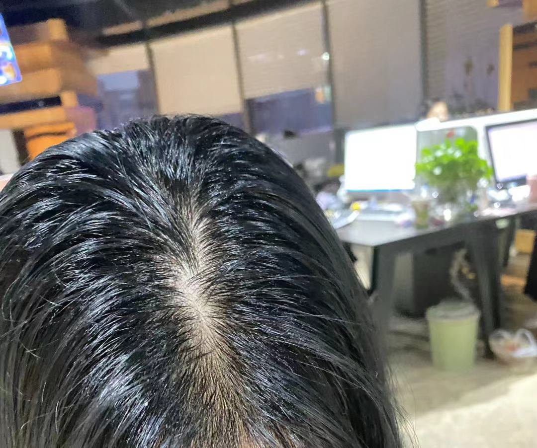 洗發水并非越貴越好！這4款口碑不錯的洗發水，控油又養發