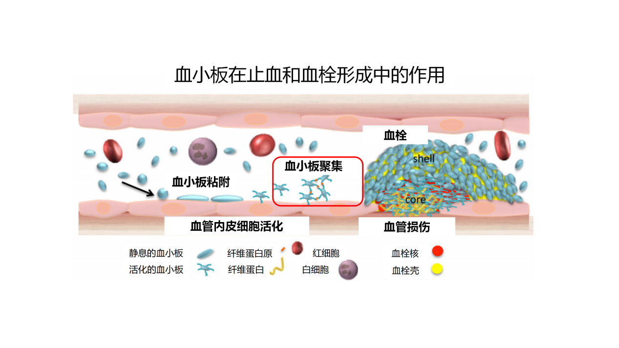 关注血小板的正常值？先看看血小板与血栓的关系！赶紧收藏