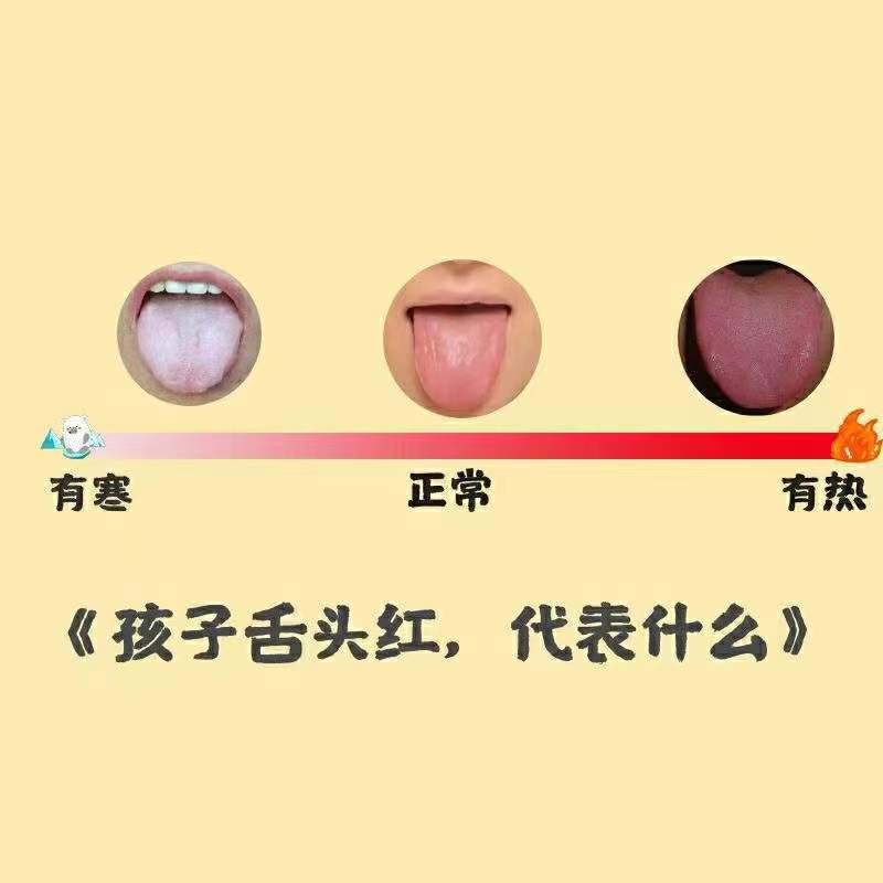 一张图，教你学会看孩子舌苔