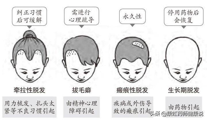 年纪轻轻，怎么就秃了？脱发究竟能不能治好？一文为你讲清楚