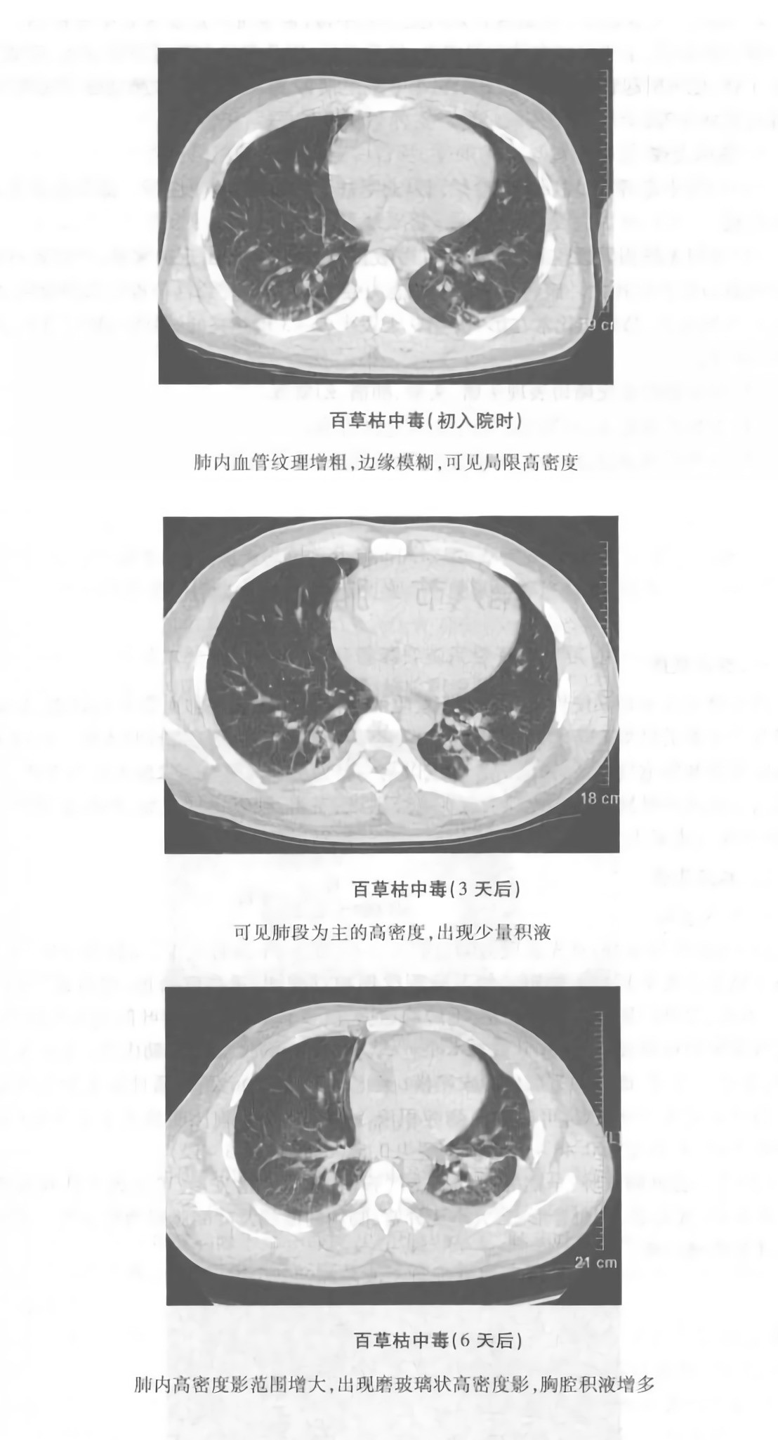 带你体验一遍百草枯的威力，活着感受死亡的痛苦，后悔却无法生还