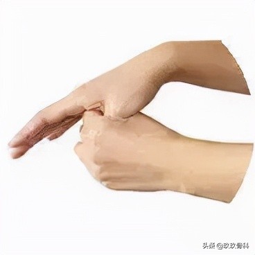 健康科普 | 手指关节痛是什么原因？