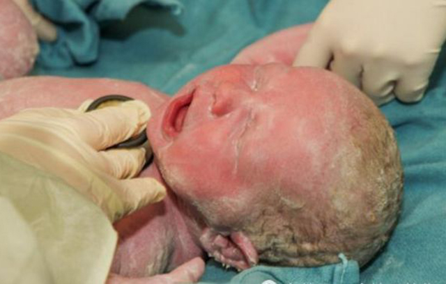 刚出生的混血婴儿图片图片