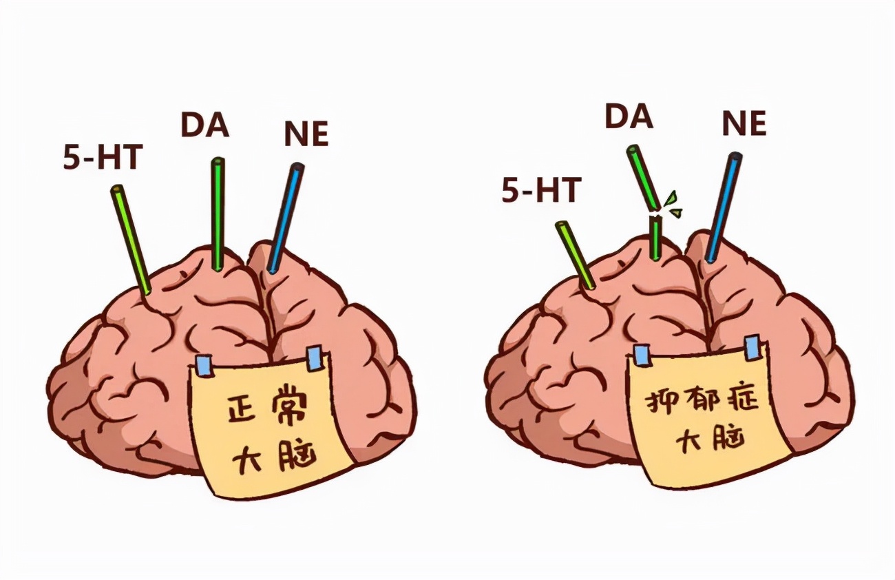 运动改造大脑丨尽全力比跑得快更重要