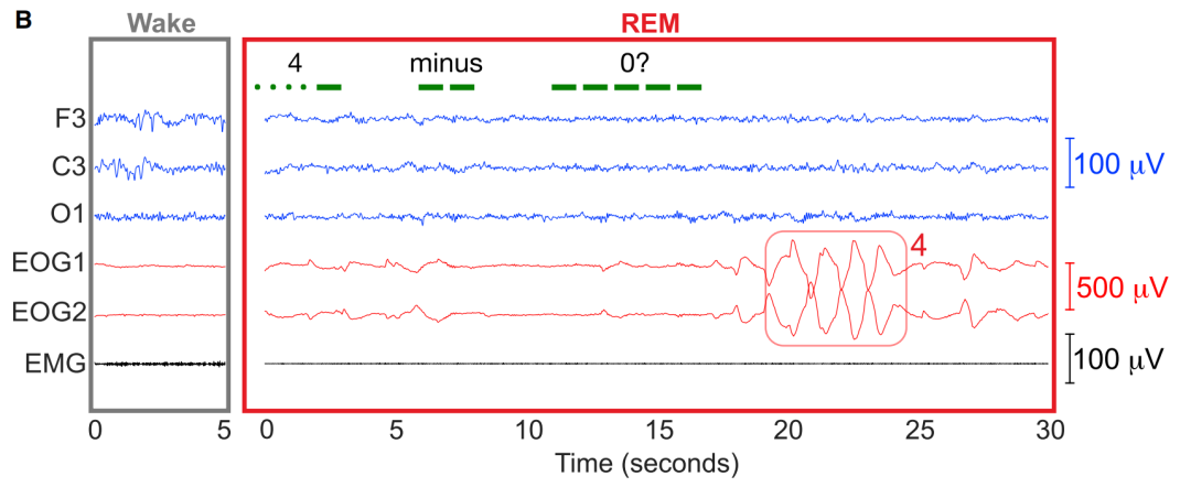 人在睡觉时能回答问题，还会做数学题？这确实是真的