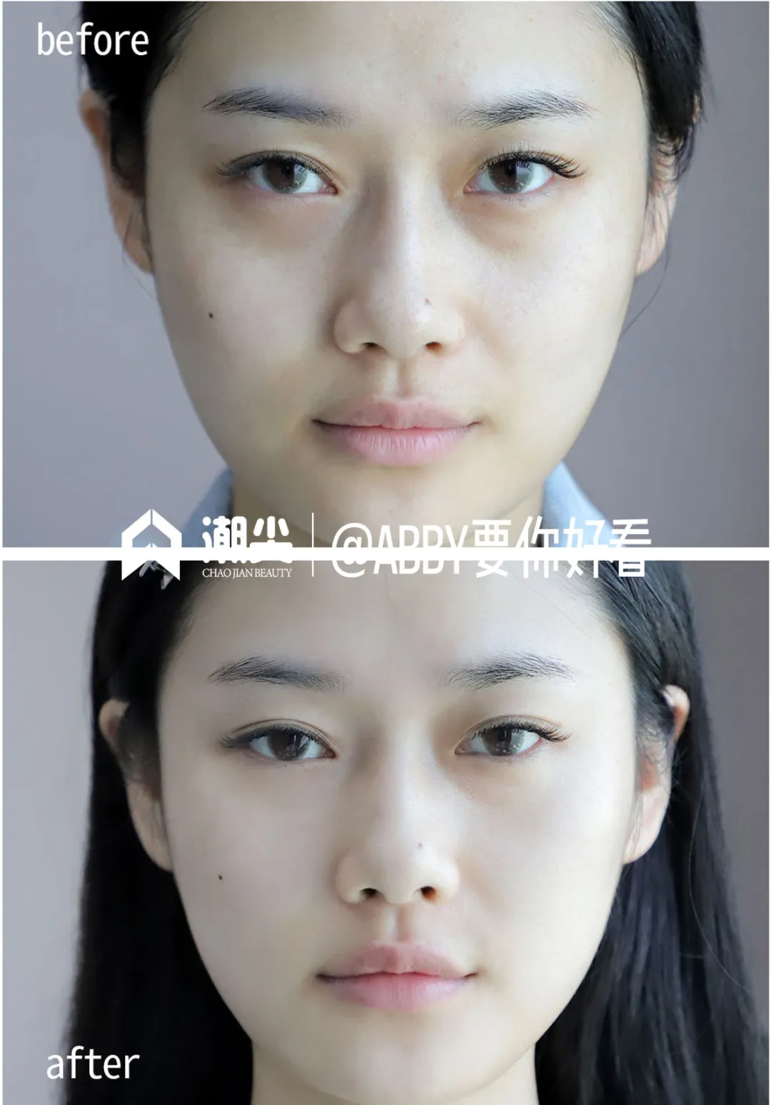 荣晟医用冷敷贴效果怎么样,好用吗