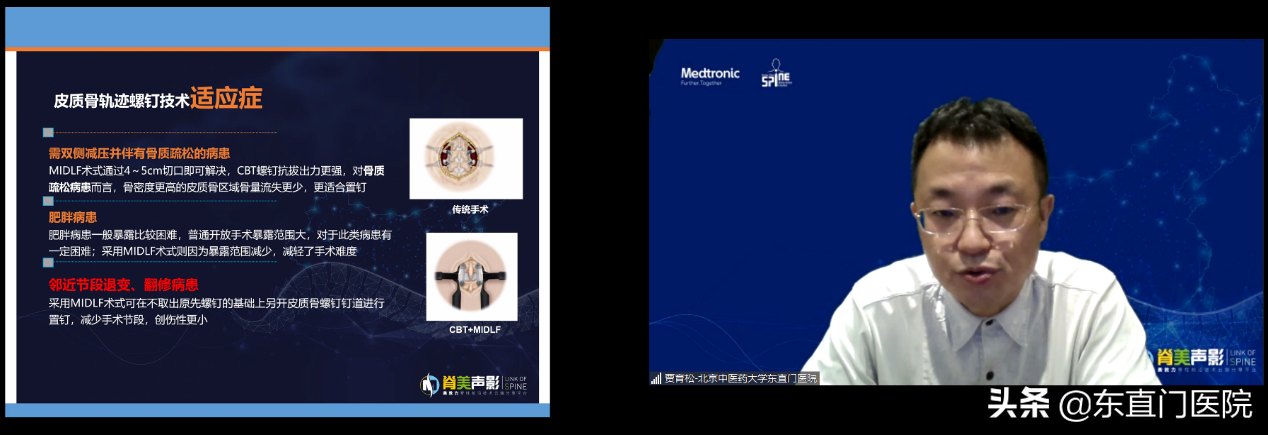 东直门医院骨科贾育松教授受邀参加"胸腰椎复杂病例研讨沙龙"