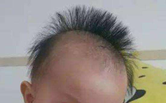 为啥新生儿有的头发多，有的少？4个方法，让宝宝告别“小秃头”