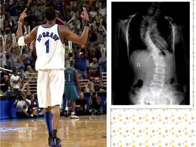 nba球员哪些有颈椎病(有身体缺陷的5大球员：麦迪先天性脊柱弯曲，医生断定生涯不超5年)