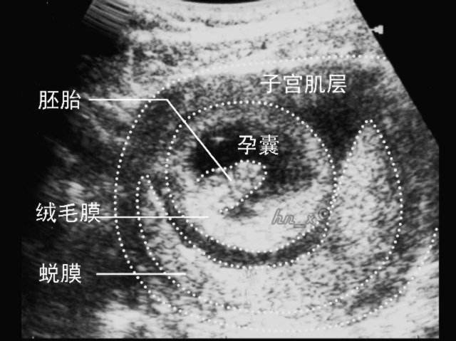春节后怀疑自己怀孕了怎么办？三招判断：看表现、用工具、做检查