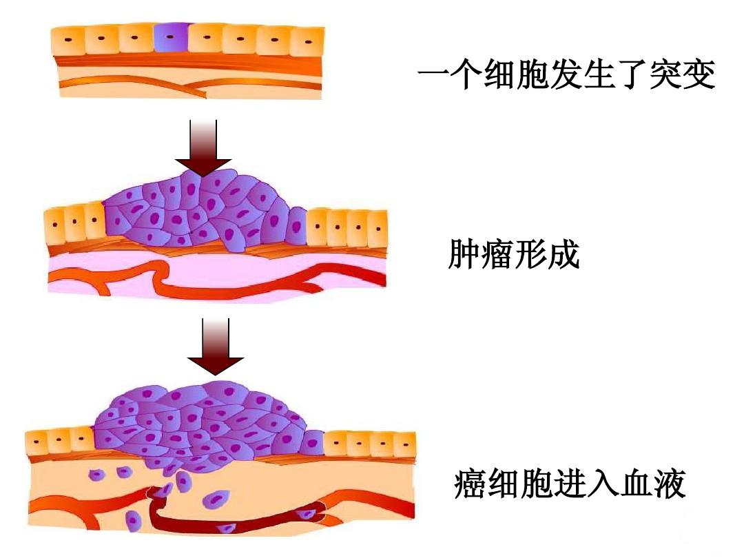 想要一生不患癌症，是否有可能？医生给出这几点建议，请收藏