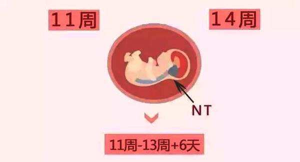 孕妇怎么做NT检查才顺利？注意做好这4点，分分钟顺利通过NT检查