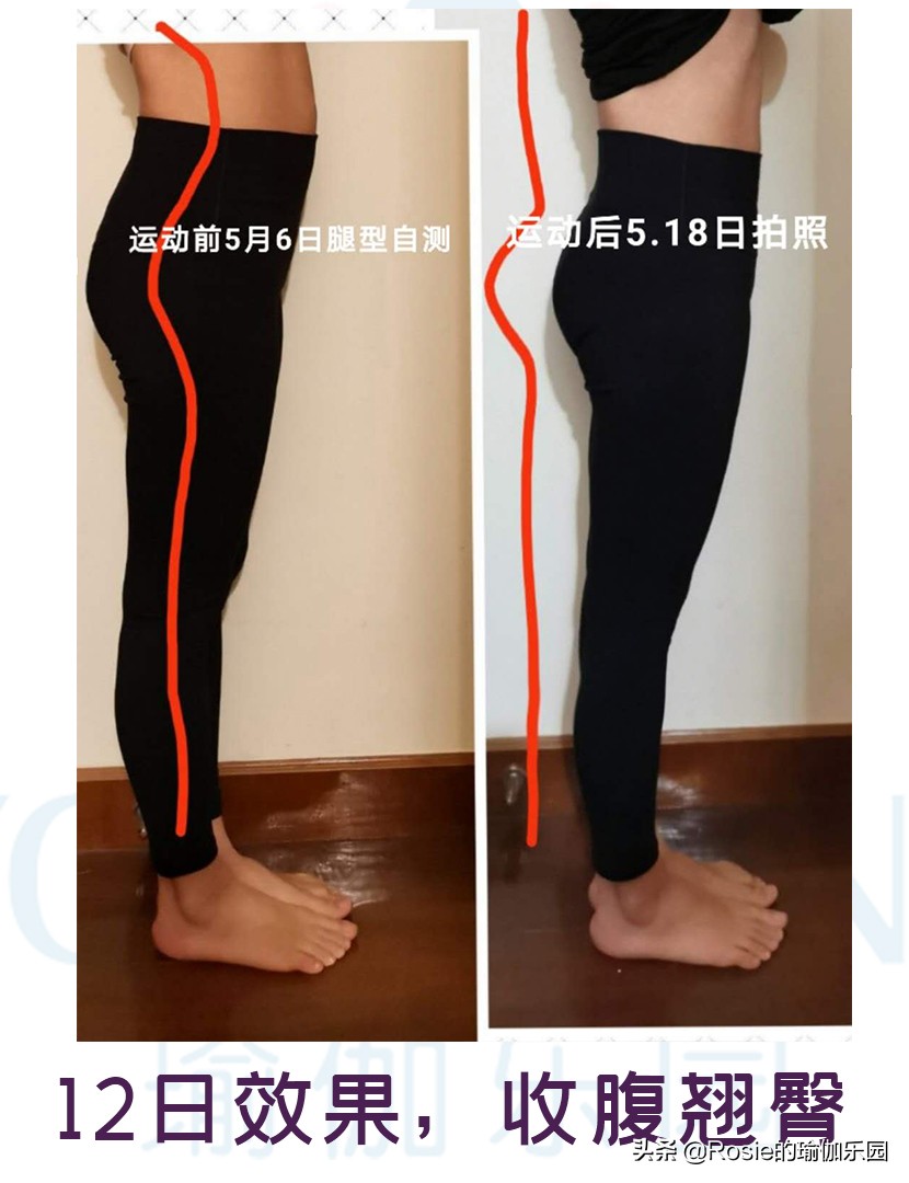 假胯宽、臀肥腿壮？要瘦腿先分清粗腿成因，不走弯路美腿这样瘦