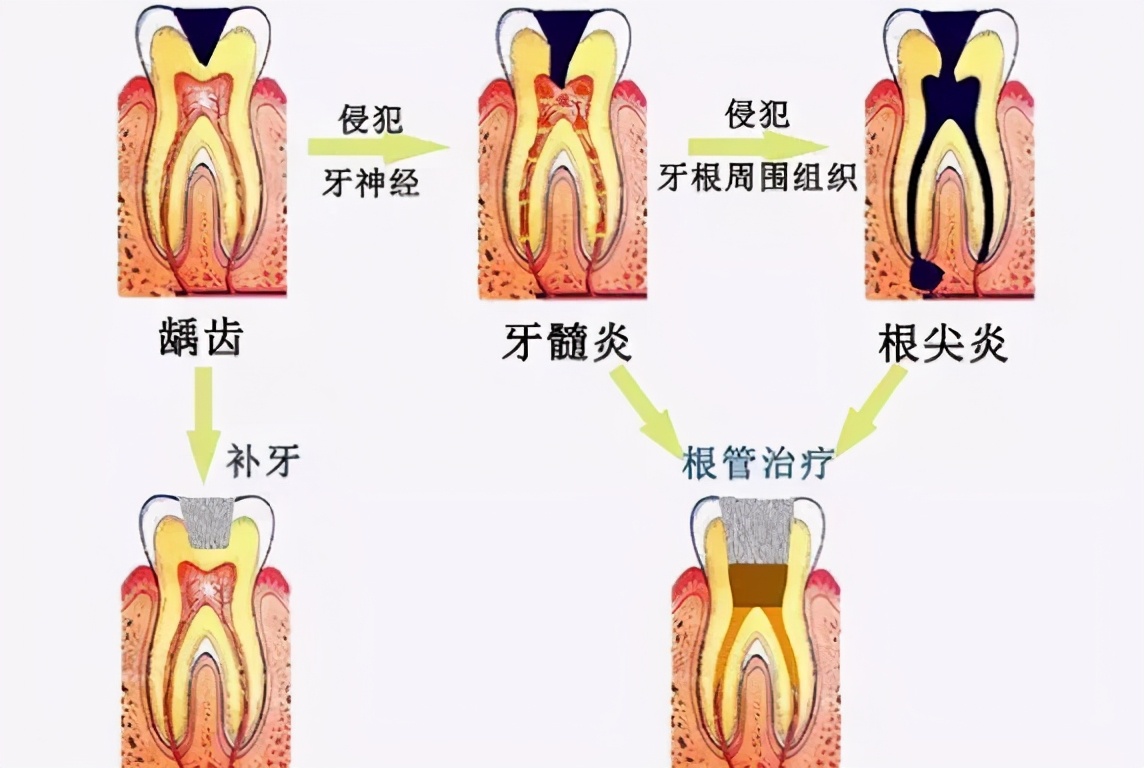 看个牙都要拍片，难道是小题大做吗？