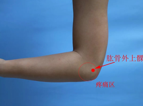 胳膊疼痛咋回事？