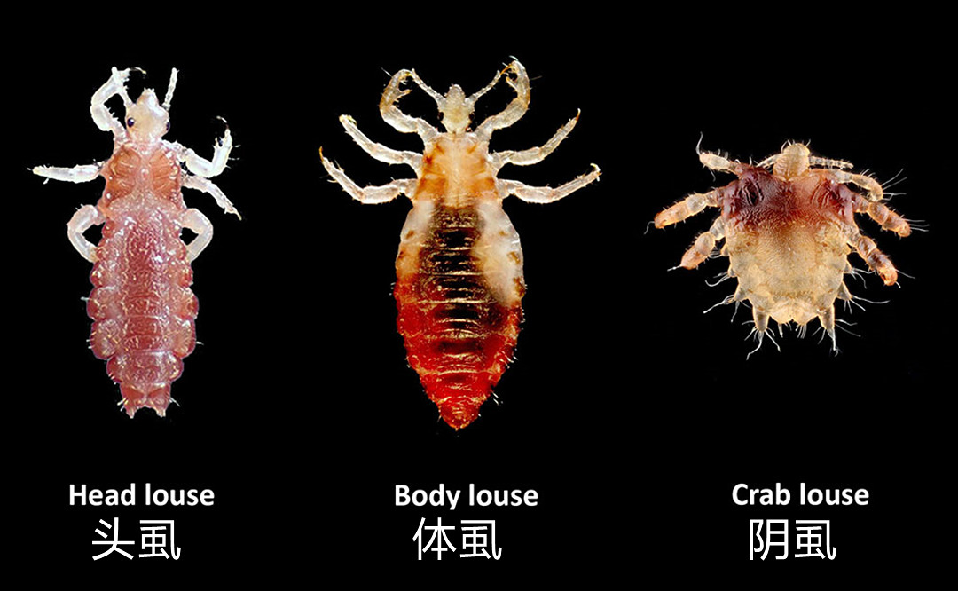 头发虱子图片(阴虱这种小虫子只寄生在人身上) - 赤虎壹号