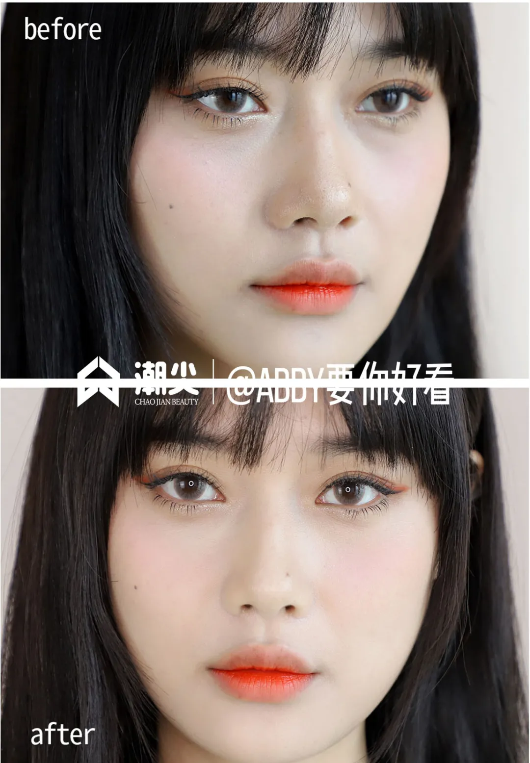 荣晟医用冷敷贴效果怎么样,好用吗