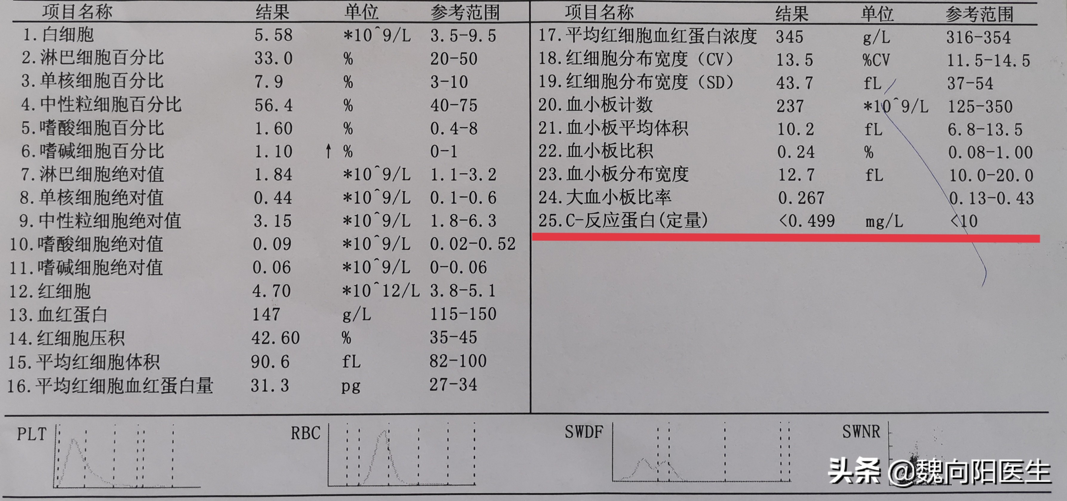 发热为甚么要化验C反应蛋白？手把手教你读化验报告之5）