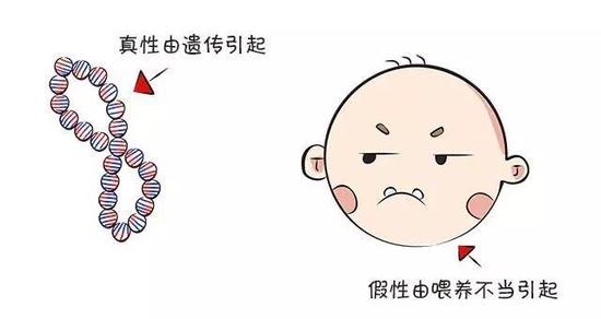 "地包天"不该成为困扰你的原因，矫正要趁早，完成后能直接变美