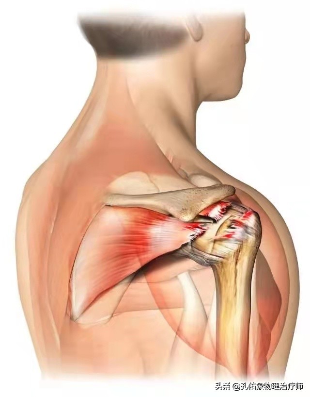 肩膀疼痛是怎么回事?问题在哪?您找对没?教您5个锻炼方法