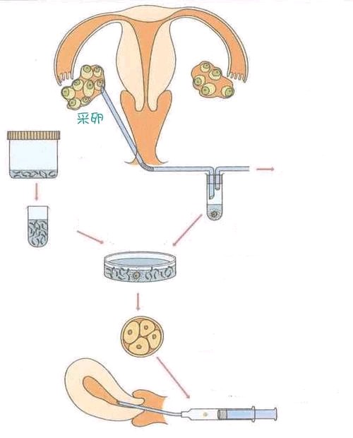 常说的“试管婴儿”，到底是什么？