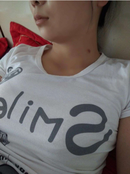 tag信息列表脖子种草莓第二天疼