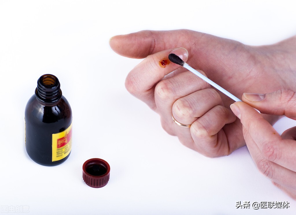 不小心受伤了,直接涂抹碘酒就行了?外伤该如何来处理?