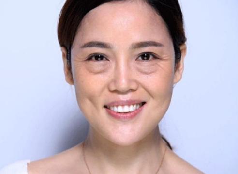 眼袋,黑眼圈是颜值"杀手",教你几招轻松消除