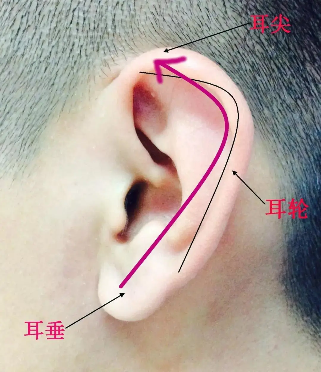 华西郑芸教授放大招：学会这5点，轻松缓解耳鸣