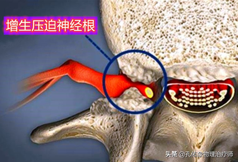 常手麻、手痛，究竟是哪里的问题？不出意外，这5种可能性最大