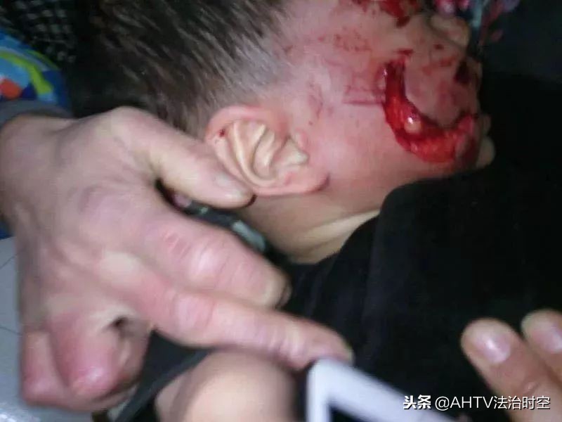 说法丨被寄养在老板家的藏獒咬伤，该找谁赔偿？