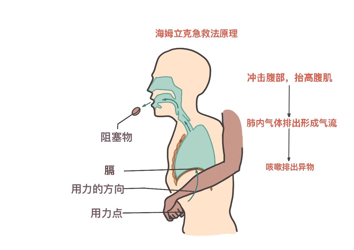 关键时刻能救命，针对不同人群的海姆立克急救方法，超详细图解