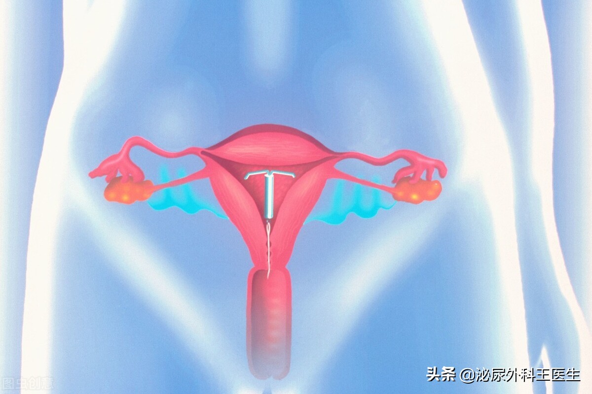 女人切除子宮，对性生活有什么影响呢？