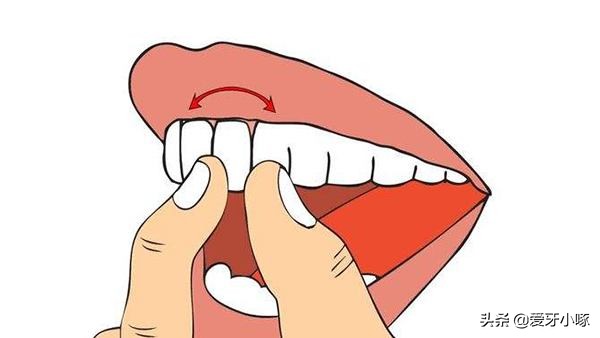 牙齿松动怎么办？别急！这几种方法来解救你