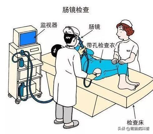 肠镜不是人人都能做——做肠镜，应该注意哪些事情？
