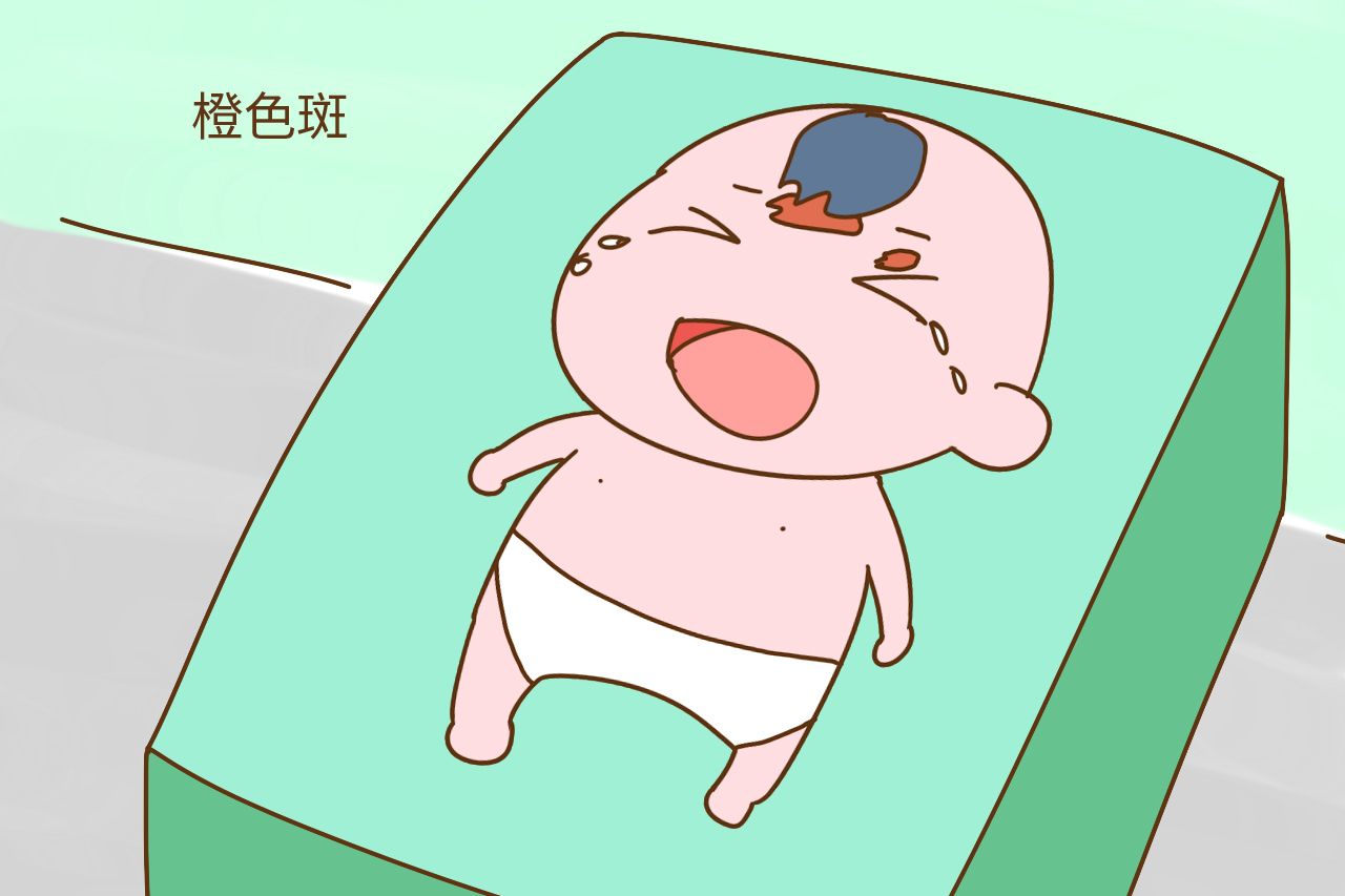 婴儿胎记是怎么形成的(宝宝的胎记是怎么来的) - 乐宝宝贝