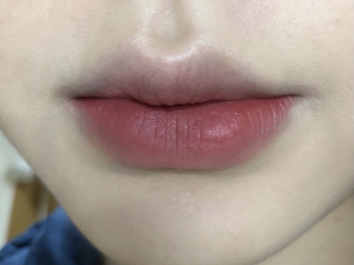 嘴唇经常起干皮,还越来越"紫"?可能是这几个原因,很影响颜值