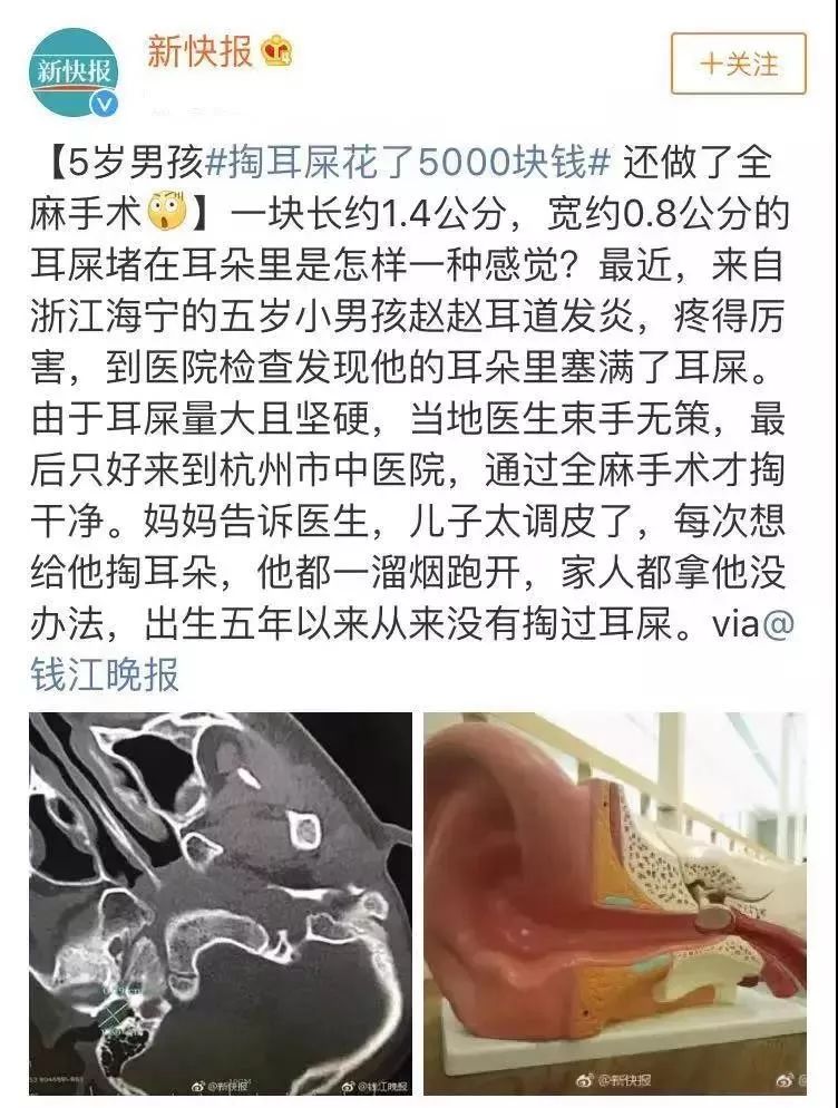 给宝宝去医院掏耳朵花掉5000！快来get正确姿势