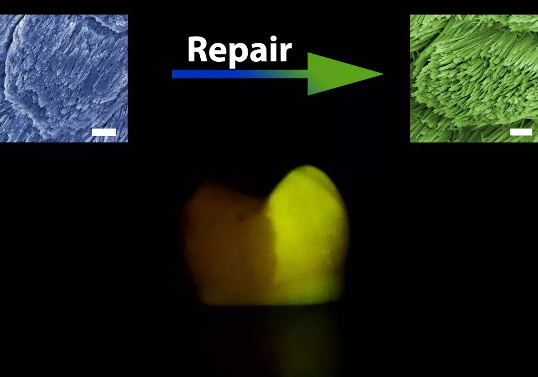 浙大最新黑科技！只要两滴药水，“补牙”不再是难事！