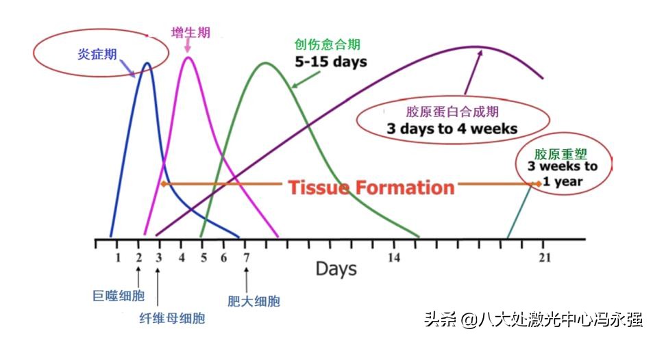 热玛吉是什么？有什么作用、效果、不良反应？