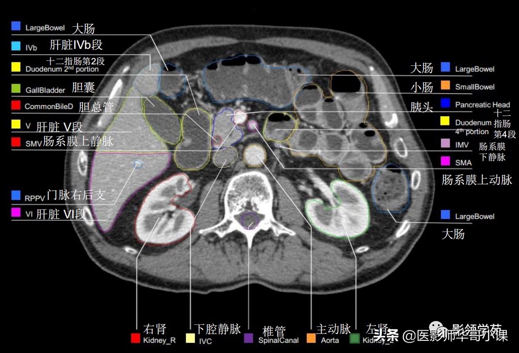 肝ct分段解剖示意图图片